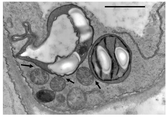 Figure 4 Nucleus Endoplasmic reticulumLyticvacuole Mitochondria Chloroplast Plasma membraneBA