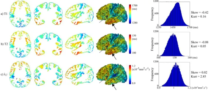 Figure 4: Average maps of quantitative parameters over the infants group. For T1 (a), T2 (b)  and λ //  (c) parameters, average 2D maps were computed within the cortical ribbon and over  the 17 infants after the DISCO+DARTEL registration