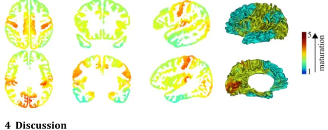 Figure 8: Average  clustering map over the infants group. Average 2D map was computed  within the cortical ribbon and over the 17 infants after the DISCO+DARTEL registration