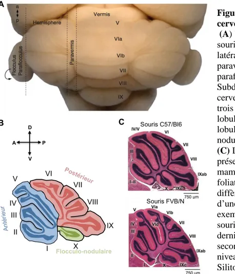 Figure  7:  Morphologie  du  cervelet 