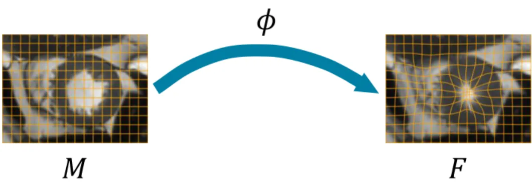 Fig. 2.1: The registration process: the moving image M is matched to the fixed image F by applying the deformation field φ