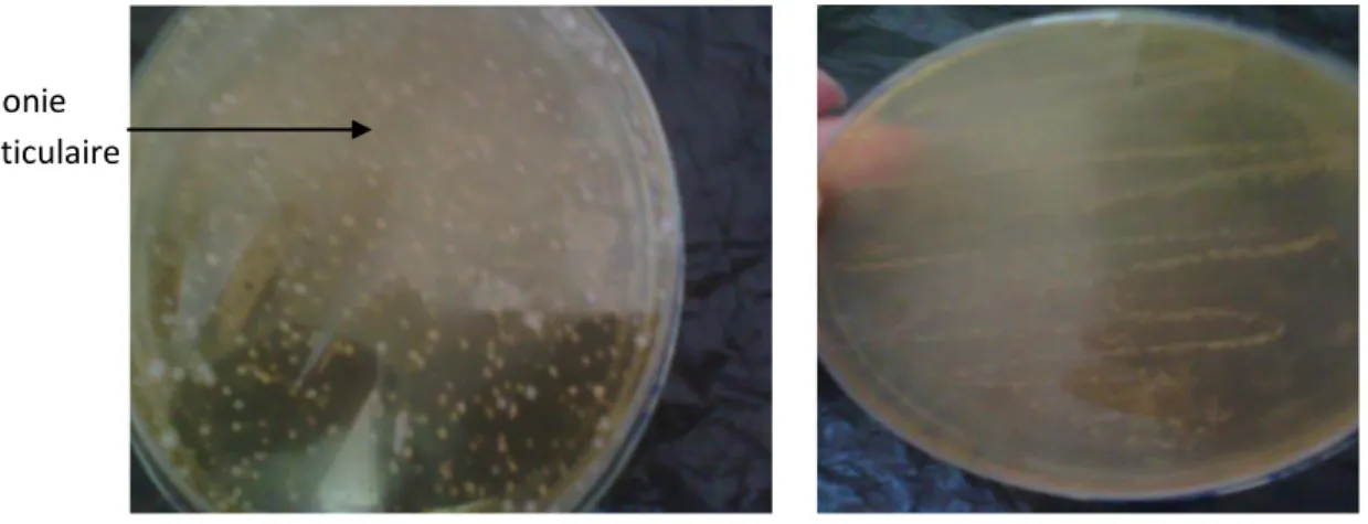Figure 8 :    Aspect des bactéries lactiques sur milieu MRS, lenticulaires de couleur blanche Colonie 