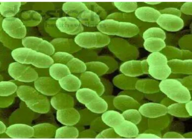 Figure 6  : Streptococcus thermophilus, au microscope électronique (Corrieu et Luquet , 2008 ) 