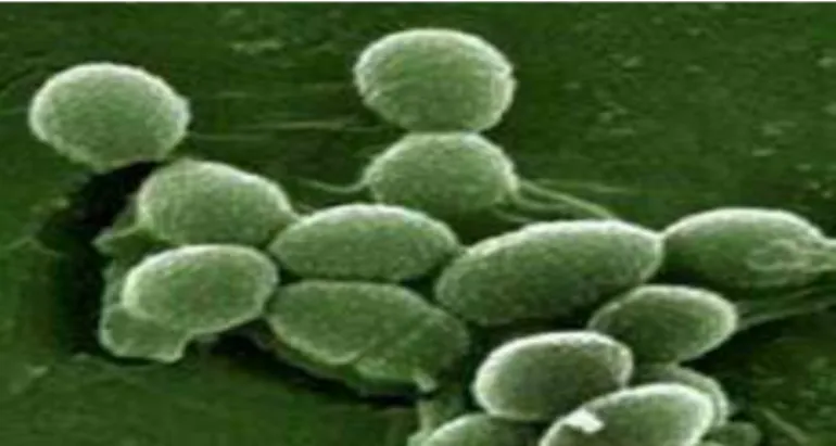Figure 8 : Enterococcus faecalis au microscope électronique ( Wallace et al , 2003 ) 