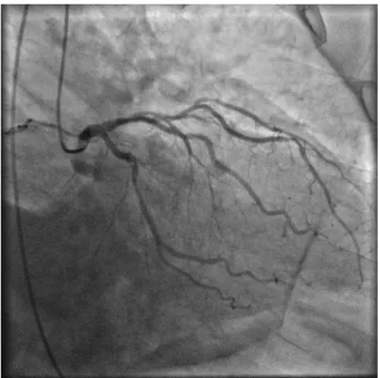 Figure 2 – Une image angiographique de vaisseaux coronaires.