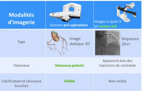 Figure 1.13 – Tableau r´ ecapitulatif des diff´ erences entre les images du scanner CT et les angiographies 2D.