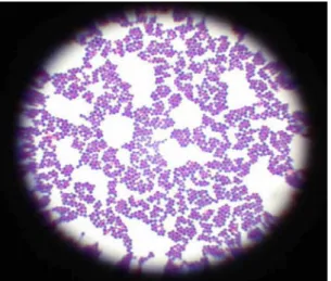 Figure n° 16 Observation microscopique de Staphylococcus aureus  