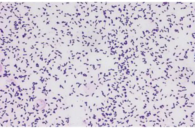 Figure n°19  Observation microscopique de Streptococcus mutans   4-2-Habitat et pouvoir pathogène  