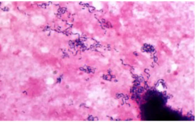 Figure n°  21 Observation microscopique de Streptococcus constellatus  