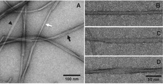 Figure 1 TEM negative staining micrographs showing Hfq C-terminal fibres