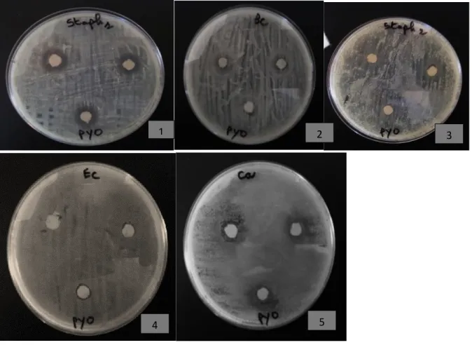 Figure 6 : l’effet de l’extrait brut (pyocyanine) sur les souches testées. 