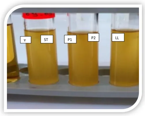Figure  10:  Résultats  obtenus  pour  le  type  fermentaire  sur  milieu  MRS  liquide  glucosé  contenant la cloche de durham 