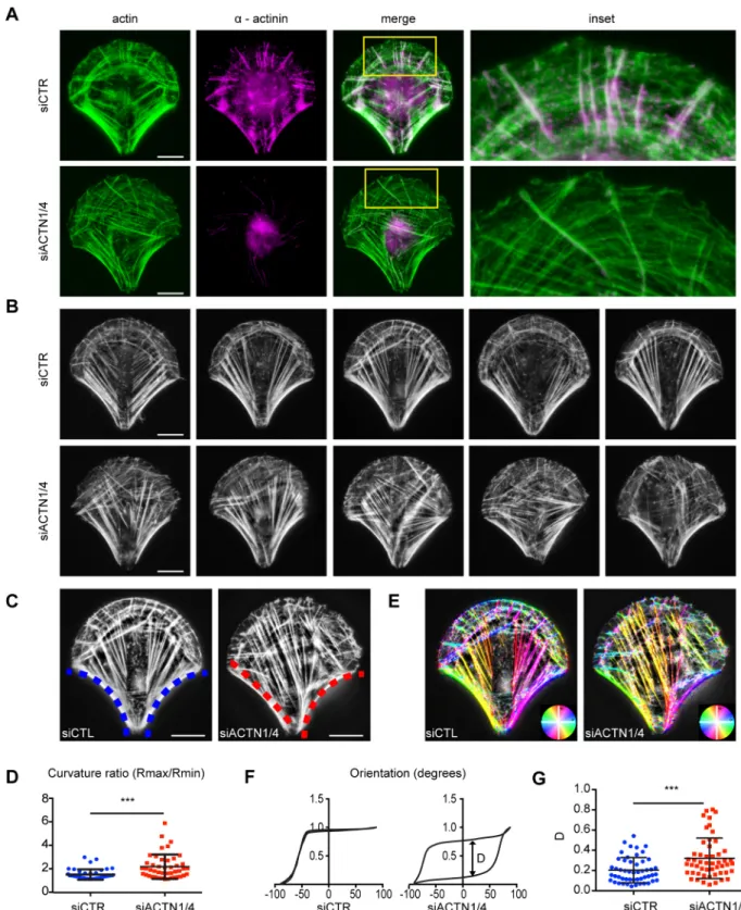 Fig. 2. Reorganization of cellular actin architecture upon α -actinin depletion. (A) RPE1 cells on crossbow-shaped micropatterns were fixed and stained for actin (green) and α -actinin (magenta)