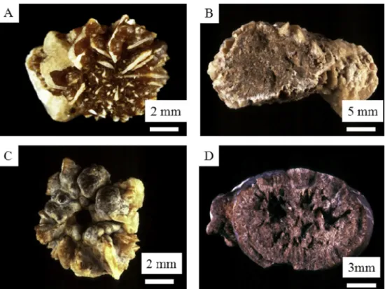 Fig. 2. Macroscopic observations of mixed COD þ COM stones: A ¼ surface e B ¼ section