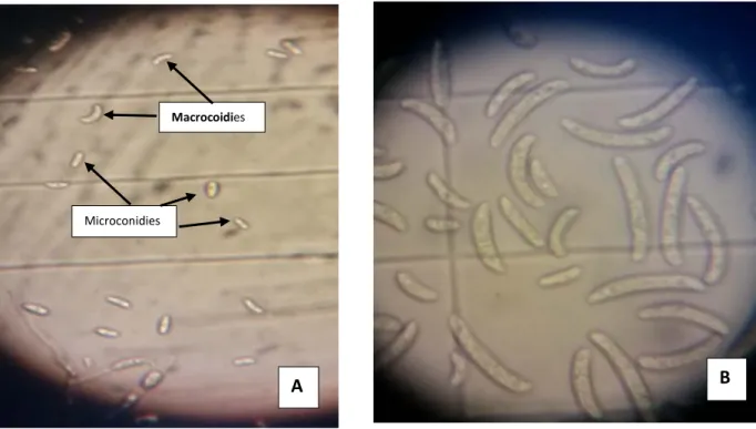 Figure n°15 : Aspects microscopiques des conidies deux isolats de Fusarium sp. 