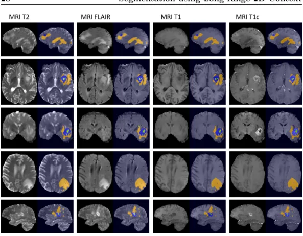 Figure 2.11: Results obtained by the 2D-3D model, displayed for each available MR sequence