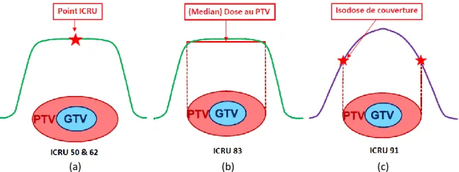 Figure I-7 : Illustration des différentes façons de prescription de dose recommandées par l’ICRU : traitements  conformationnelles 3D (a), traitements avec modulation d’intensité (b) et traitements stéréotaxiques (c) 