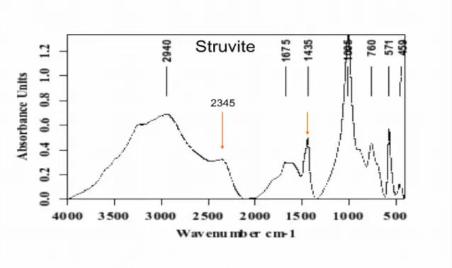 Tableau 4: Principales fréquences de vibrations de la struvite (spectre de référence 4).