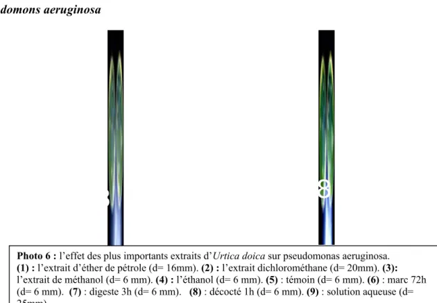 Tableau 18: l’effet des extraits d’Urtica doica sur les bactéries exprimé en diamètre    