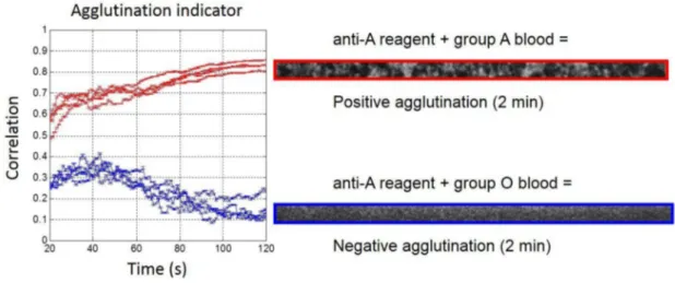 Figure 3. (Left) Real-time agglutination indicator measurement for the eight experiments of the validation set with 1:5 diluted bloods (Red: Group A and Blue: Group O) for anti-A reagent biochips.