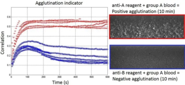 Figure 4. (Left) Real-time agglutination indicator measurement for the ten experiments of the validation set with undiluted bloods (Red: Group A and Blue: Group B) for anti-A reagent biochips.
