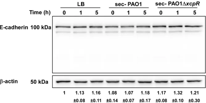 Figure 8. E-cadherin is resistant to LasB proteolysis. Epithelial A549 cells were treated with PAO1 or PAO1DxcpR secretomes (10% v/v in culture medium)