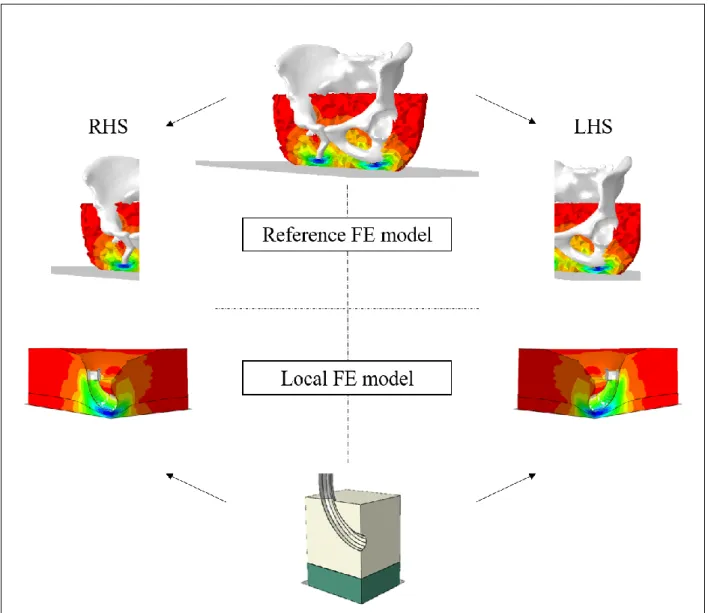 Figure 1: Reference FE model (top) and associated LHS and RHS local FE models (bottom) for one subject