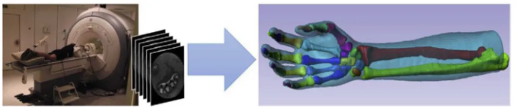Fig. 2. High resolution MRI acquisition and personalized hand internal model.