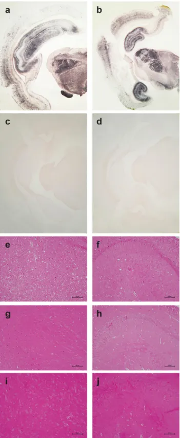 Fig 5. Pathological PrP deposition and vacuolation in the brains of wild-type and tgOv rabbits inoculated with LA21K fast scrapie prions
