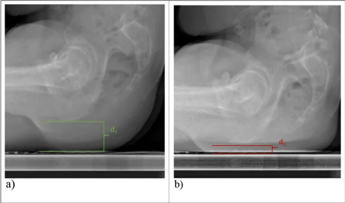 Fig. 2. Sagittal radiography of the unloaded and loaded sitting posture (respectively left and right)