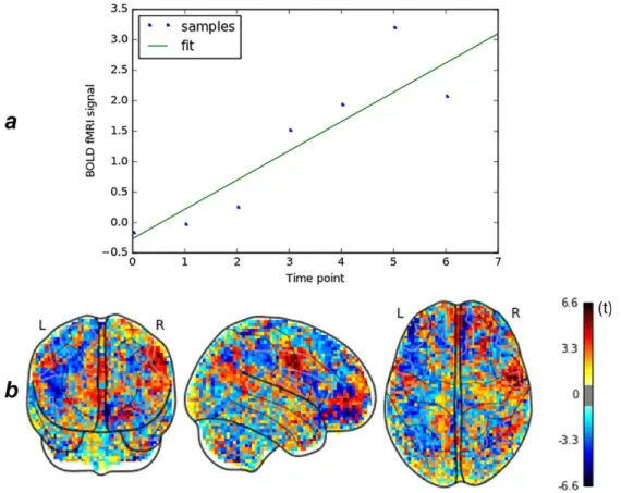 Figure 1a represents the evolution of the signal intensity in one single voxel over the 8 consecutive volumes of a prehallucination period of a subject