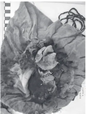 Figura 15. Cabeza fragmentada de un infante ha- ha-llado al interior del tejido ilustrado en la Figura 