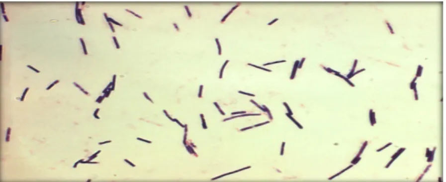 Figure N°03 : Micrographie électronique à Staphylococcus aureus sous un  grossissement balayage (MEB) montre une souche de la bactérie (Joffin et 