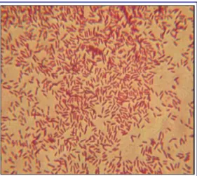 Figure 10 :Aspect microscopique de P.aeruginosa aprèscoloration de Gram 