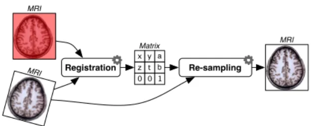 Figure 1: A typical neuroimaging workflow mixing several nature of data and processing.