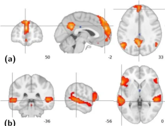 Figure 1: Intrinsic functional networks extracted from fMRI datasets of on-going activity, adapted from [28]