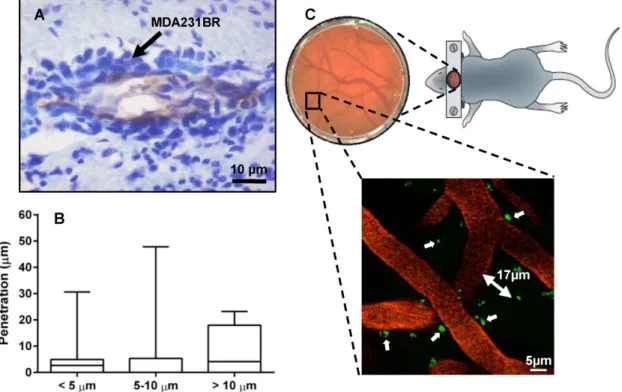 Figure 2. (A) Immunohistochemical detection of brain metastases. Photomicrograph of tumor colonies showing co-localization of VCAM-1 (brown) with brain  metastasis (violet) at day 21 after intra-cardiac injection of MDA231BR cells