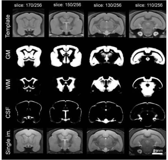 Fig. 2. Template of the mouse lemur brain compared to probability maps and a representative image from a single animal.