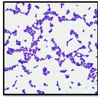 Figure 7: Coloration de Gram de Staphylococcus aureus, gram positive cocci (Fitzgerald,  2001)
