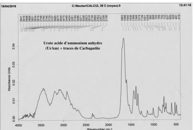 Figure n o  14: Spectres infrarouge d’un calcul composé d’un mélange : Whewellite+ carbapatite +  trace de weddellite