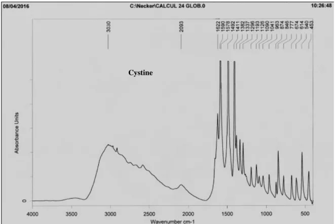 Figure n o  16: Spectres infrarouge de la section d’un calcul, composée d’un mélange : Whewellite+ 