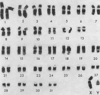 Figure 01 : Caryotype d’un étalon obtenu par la méthode des ban ding G (Cribiuet al, 1998)