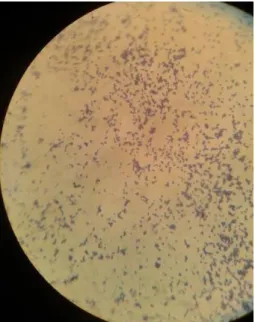 Figure 5 : Observation microscopique de M5 
