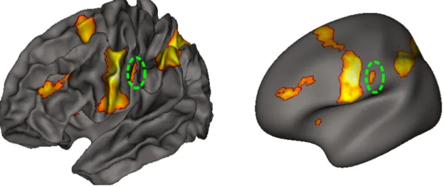Figure 7: Potential issues with fMRI data projection to the cortical surface. (top) The activity on the pre-central gyrus for a computation task has also been projected on the neighboring gyrus (post-central gyrus) in a fraction of the subjects, and the en