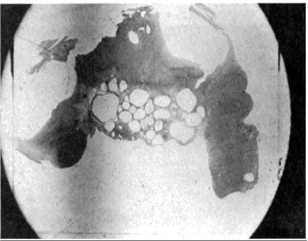 Figure 6 : Photographie d’une coupe histologique d’ovaire montrant des kystes  d’inclusions dans le tissu ovarien autour de la fosse d’ovulation rencontrés sur des vielles 