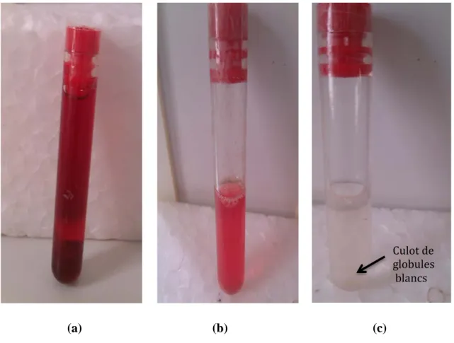 Figure 7 : La phase de lyse des globules rouges 