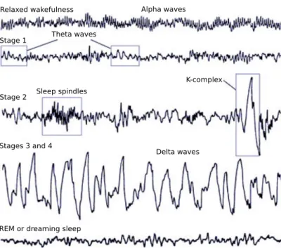 Figure 2.9: Brain activity during different sleep stages. The detection of transient sleep spindles and K-complexes, for example, can help in diagnosing stage 2 sleep.