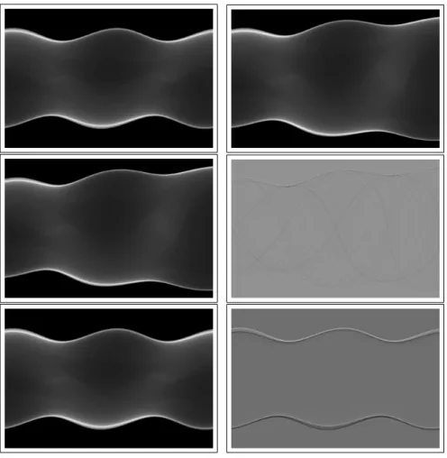 Figure 6: Sinograms in fan beam geometry. First line, left: sinogram of the static phantom