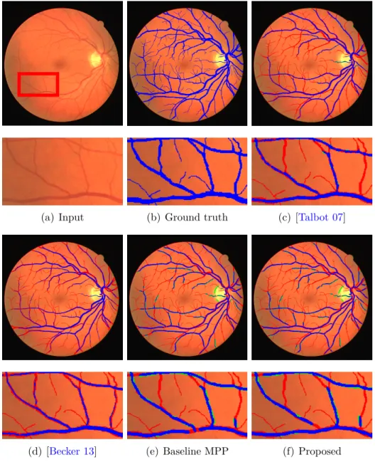 Figure 3.13: We visualize the localization of the curvilinear structures on a Retina image