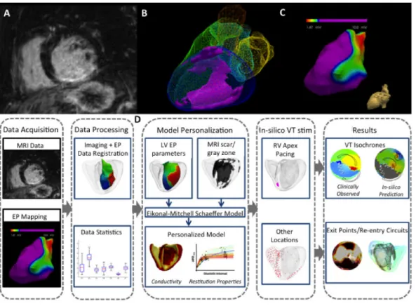 Figure 3.1: Personalized computer modelling process. Upper panel: (A) high- high-resolution contrast-enhanced MRI scar images; (B) whole heart model segmented from 3D steady-state free precession (SSFP) MRI with scar (core and gray zone) in violet; (C) low